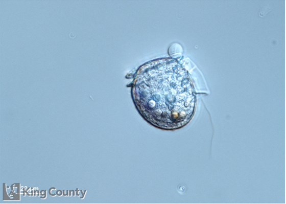 Photo of Dinophysis rotundata